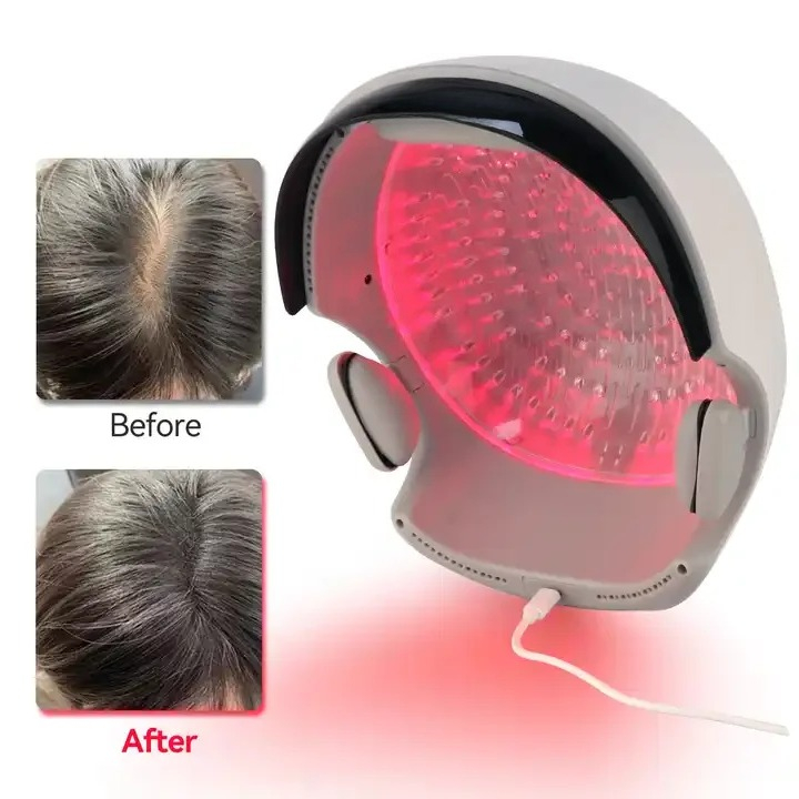 Hair Care Lab - Kırmızı Işıklı Saç Çıkarma Kaskı, Saçların