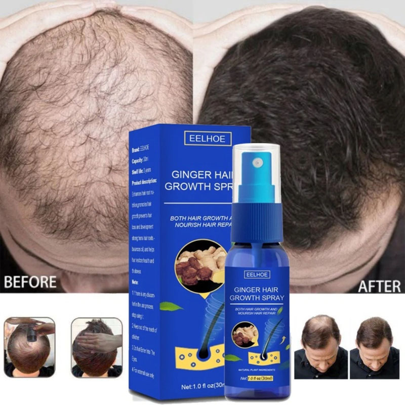 Zencefil Saç Büyüme Serumu Spr - Hair Care Essence Oil Spray incelemesi ve fiyatı
