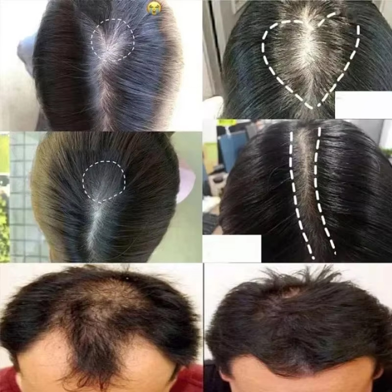 Zencefil Saç Büyüme Serumu Spr - Hair Care Essence Oil Spray incelemesi ve fiyatı