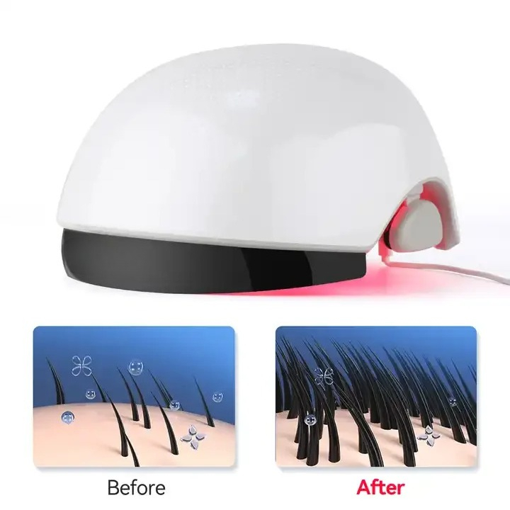 Kırmızı Işıklı Saç Çıkarma Kas - Hair Care Lab incelemesi ve fiyatı